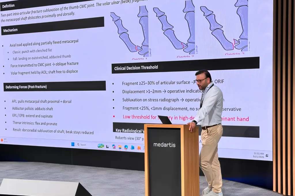 البروفيسور الدكتور سامي حسن يحاضر على منصة أمام شريحة عن كسور قاعدة الإبهام